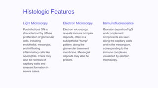 Histologic Features
Light Microscopy
Postinfectious GN is
characterized by diffuse
proliferation of glomerular
cells, including
endothelial, mesangial,
and infiltrating
inflammatory cells like
neutrophils. There may
also be necrosis of
capillary walls and
crescent formation in
severe cases.
Electron Microscopy
Electron microscopy
reveals immune complex
deposits, often in a
subepithelial "hump"
pattern, along the
glomerular basement
membrane. Mesangial
deposits may also be
present.
Immunofluorescence
Granular deposits of IgG
and complement
components are seen
along the capillary walls
and in the mesangium,
corresponding to the
immune complexes
visualized by electron
microscopy.
 