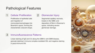 Pathological Features
1 Cellular Proliferation
Proliferation of epithelial cells
and migration of
monocytes/macrophages into
Bowman's space, forming the
characteristic crescent shape.
2 Glomerular Injury
Segmental capillary necrosis,
breaks in the GBM, and
deposition of fibrin in Bowman's
space, indicating severe
glomerular damage.
3 Immunofluorescence Patterns
Linear staining of IgG and C3 along the GBM in anti-GBM disease,
granular staining in immune complex-mediated GN, and negative staining
in pauci-immune GN.
 