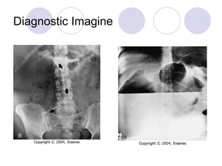 Diagnostic Imagine 
