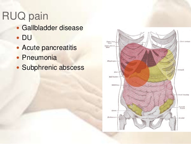 Acute abdomen