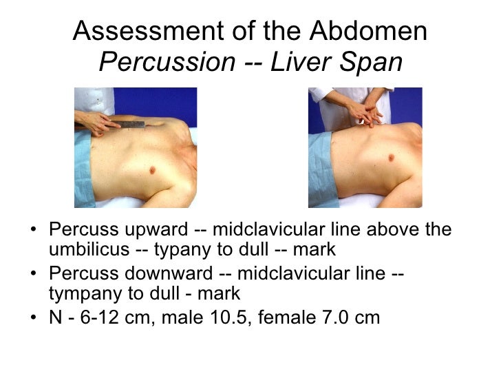 Acute Abdomen