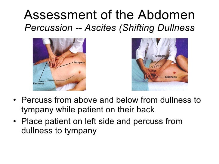 Acute Abdomen