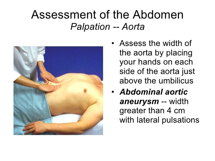 Acute Abdomen