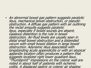 Acute abdomen | PPSX