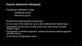 Supine abdominal radiograph
• Oval/linear collection of gas
- Subhepatic space
- Morrison’s pouch
• Beneath the diaphragm(the cupola sign)
• In the center of the abdomen over a fluid collection(the football sign)
• Visualization of the outer as well as the inner wall of loop of bowel
(Rigler’s sign)
• Visualization of falciform ligament, medial and lateral umbilical ligament
and the urachus.
• In the fissure of ligamentum teres
11
 