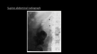Supine abdominal radiograph
 