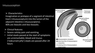 Intussusception
 Characteristics
Invagination or prolapse of a segment of intestinal
tract ( intussusceptum) into the lumen of the
adjacent intestine ( intussuscipiens).
90% are ileocolic and ileo-ileocolic.
 Clinical features
• Severe colicky pain and vomiting.
• Initial stools passed at the start of symptoms
are unremarkable; blood and mucus
(‘redcurrant jelly’) stools are passed after 24
hours
 