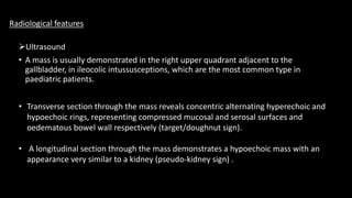 Ultrasound
• A mass is usually demonstrated in the right upper quadrant adjacent to the
gallbladder, in ileocolic intussusceptions, which are the most common type in
paediatric patients.
• Transverse section through the mass reveals concentric alternating hyperechoic and
hypoechoic rings, representing compressed mucosal and serosal surfaces and
oedematous bowel wall respectively (target/doughnut sign).
• A longitudinal section through the mass demonstrates a hypoechoic mass with an
appearance very similar to a kidney (pseudo-kidney sign) .
Radiological features
 