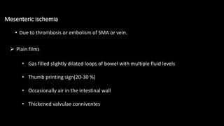 Mesenteric ischemia
• Due to thrombosis or embolism of SMA or vein.
 Plain films
• Gas filled slightly dilated loops of bowel with multiple fluid levels
• Thumb printing sign(20-30 %)
• Occasionally air in the intestinal wall
• Thickened valvulae conniventes
 