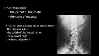  Plain film can assess
• the extent of the colitis
• the state of mucosa
 State of colonic mucosa can be assessed from :
- the faecal residue
- the width of the bowel lumen
-the mucosal edge
-the haustral pattern
 