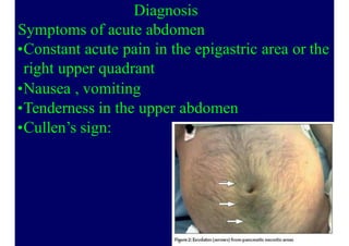 Diagnosis
Symptoms of acute abdomen
•Constant acute pain in the epigastric area or the
right upper quadrant
•Nausea , vomiting
•Tenderness in the upper abdomen
•Cullen’s sign:
38
 