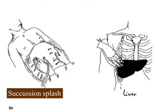 49
Succussion splash
 