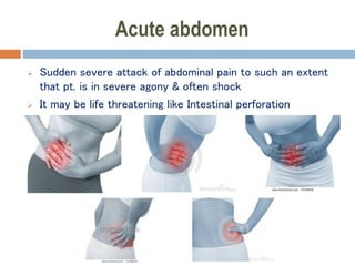 Acute abdomen
 Sudden severe attack of abdominal pain to such an extent
that pt. is in severe agony & often shock
 It may be life threatening like Intestinal perforation
 