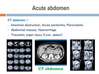 Acute abdomen
CT abdomen :-
 Intestinal obstruction, Acute peritonitis, Pancreatitis
 Abdominal masses, Haemorrhage
 Traumatic organ injury (Liver, spleen)
CT abdomen
 