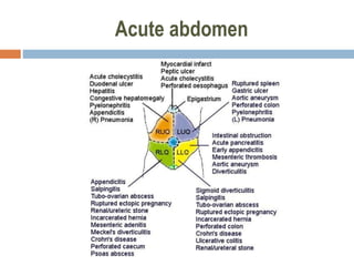 Acute abdomen
 