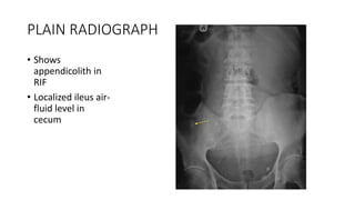 Acute abdomen | PPTX