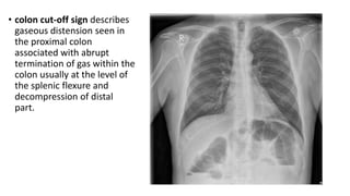 Acute abdomen | PPTX