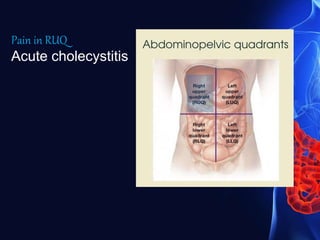 Pain in RUQ
Acute cholecystitis
 