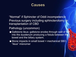 “Normal” if Sphincter of Oddi incompetence
Previous surgery including sphincterotomy or
transplantation of CBD
Pathology (uncommon)
■ Gallstone ileus: gallstone erodes through wall of GB
into the duodenum producing a fistula between the
bowel and the biliary system.
■ Stone impacts in small bowel = mechanical SBO.
“ileus” misnomer
 