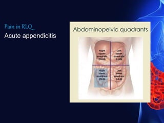 Pain in RLQ
Acute appendicitis
 