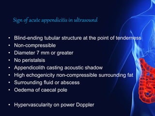 Sign of acute appendicitis in ultrasound
• Blind-ending tubular structure at the point of tenderness
• Non-compressible
• Diameter 7 mm or greater
• No peristalsis
• Appendicolith casting acoustic shadow
• High echogenicity non-compressible surrounding fat
• Surrounding fluid or abscess
• Oedema of caecal pole
• Hypervascularity on power Doppler
 