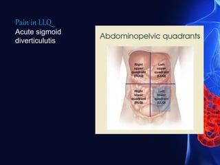 Pain in LLQ
Acute sigmoid
diverticulutis
 