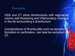 USG and CT show diverticulosis with segmental
colonic wall thickening and inflammatory changes
in the fat surrounding a diverticulum
Complications of Diverticulitis such as abscess
formation or perforation, can best be excluded with
CT.
Diverticulitis
 