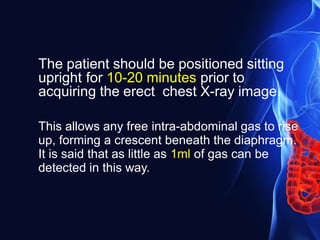 The patient should be positioned sitting
upright for 10-20 minutes prior to
acquiring the erect chest X-ray image.
This allows any free intra-abdominal gas to rise
up, forming a crescent beneath the diaphragm.
It is said that as little as 1ml of gas can be
detected in this way.
 
