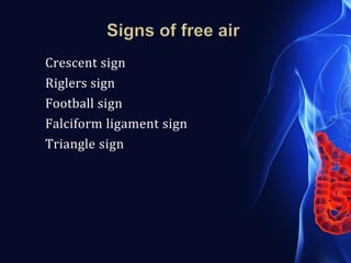 Crescent sign
Riglers sign
Football sign
Falciform ligament sign
Triangle sign
 