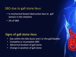 SBO due to gall stone ileus
• Is mechanical bowel obstruction due to gall
stone/s in the intestine
• 2% of SBO
Signs of gall stone ileus
• Gas within the bile ducts and / or the gall bladder
• Complete or incomplete SBO
• Abnormal location of gall stone
• Change in position of gall stone
 