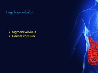 Largebowelvolvulus
 Sigmoid volvulus
 Caecal volvulus
 