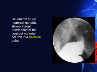 Ba. enema study
-contrast material
shows abrupt
termination of the
contrast material
column in a beaklike
point.
 