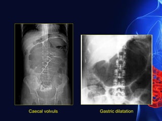Caecal volvuls Gastric dilatation
 