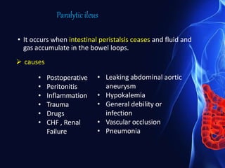 Paralyticileus
• Postoperative
• Peritonitis
• Inflammation
• Trauma
• Drugs
• CHF , Renal
Failure
• Leaking abdominal aortic
aneurysm
• Hypokalemia
• General debility or
infection
• Vascular occlusion
• Pneumonia
• It occurs when intestinal peristalsis ceases and fluid and
gas accumulate in the bowel loops.
 causes
 