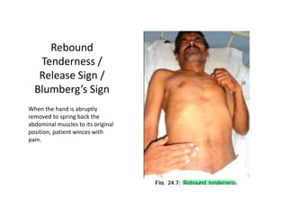 Rebound
Tenderness /
Release Sign /
Blumberg’s Sign
When the hand is abruptly
removed to spring back the
abdominal muscles to its original
position, patient winces with
pain.
 