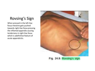 Rovsing’s Sign
When pressed in the left iliac
fossa intestine gets pushed
towards right iliac fossa pressing
the inflamed appendix causing
tenderness in right iliac fossa
which is adefinitive feature of
acute appendicitis.
 