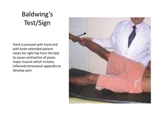Baldwing’s
Test/Sign
Flank is pressed with hand and
with knee extended patient
raises his right hip from the bed
to cause contraction of psoas
major muscle which irritates
inflamed retrocaecal appendix to
develop pain.
 