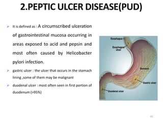  It is defined as : A circumscribed ulceration
of gastrointestinal mucosa occurring in
areas exposed to acid and pepsin and
most often caused by Helicobacter
pylori infection.
 gastric ulcer : the ulcer that occurs in the stomach
lining ,some of them may be malignant
 duodenal ulcer : most often seen in first portion of
duodenum (>95%)
61
2.PEPTIC ULCER DISEASE(PUD)
 