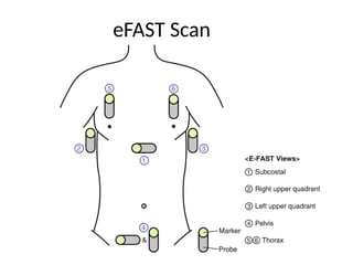 acute abdomen, management and clinical presentation | PPTX