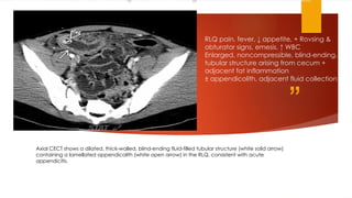 ULTTASOUND FOR ACUTE ABDOMEN IN EMERGENCY .pptx