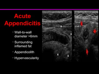 acute abdomen and imaging in trauma ug.ppt