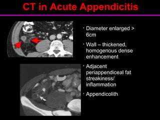 acute abdomen and imaging in trauma ug.ppt