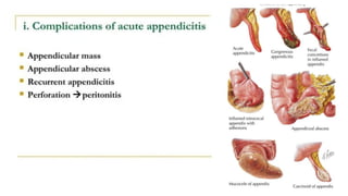 ACUTE ABDOMEN appendicitis AND peritonitis eden 2024.pptx