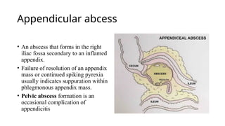 ACUTE ABDOMEN appendicitis AND peritonitis eden 2024.pptx