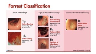acute abdomen approach in emergency dept | PPTX