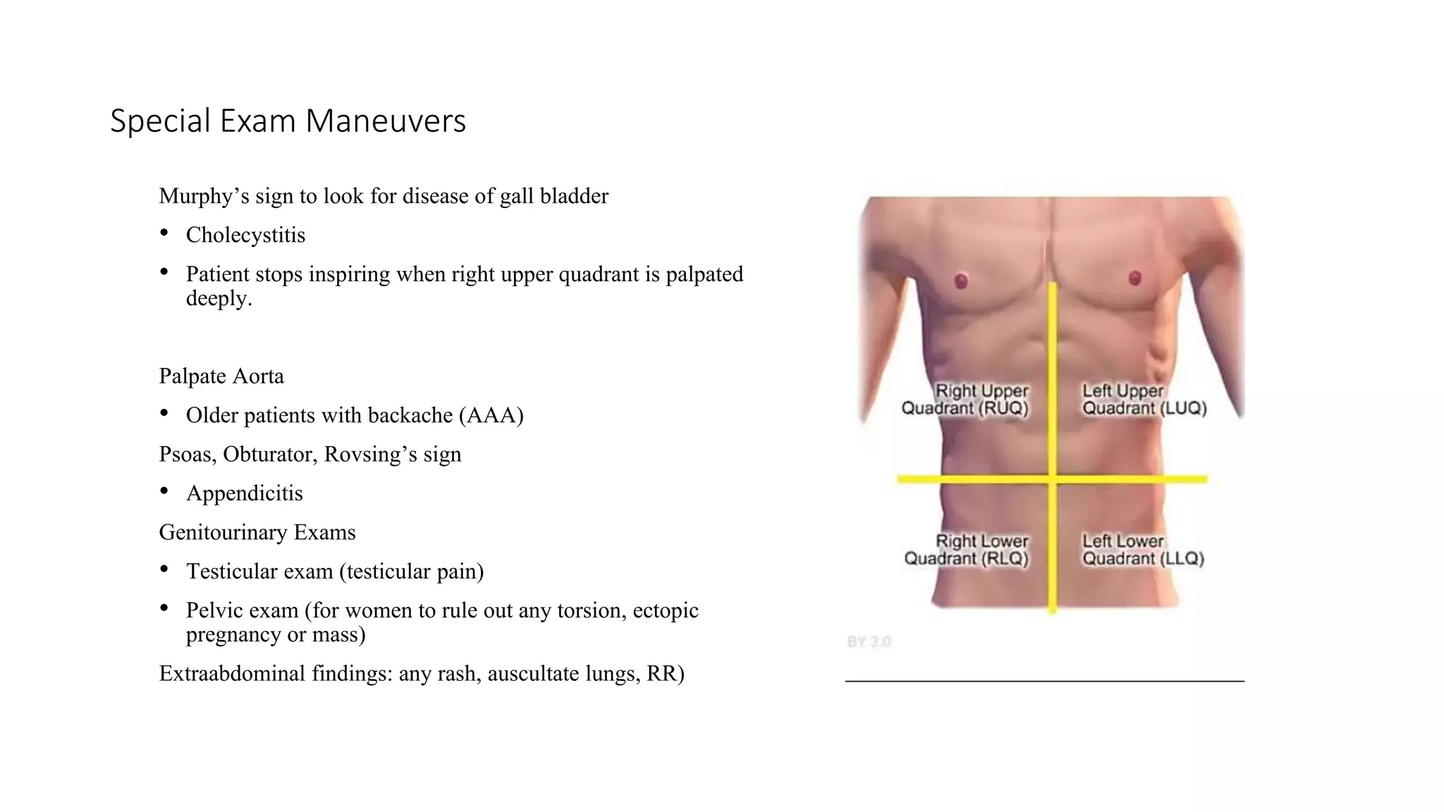 Appendix Murphy Sign Acute abdomen – general principles and approach in ED | PPTX