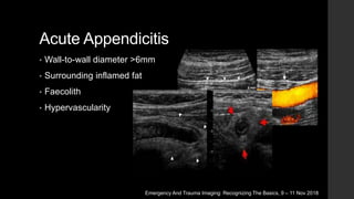 Acute Abdomen Imaging | PPTX