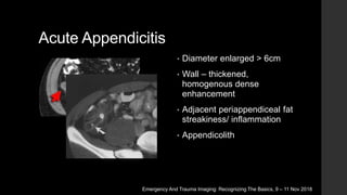 Acute Abdomen Imaging | PPTX