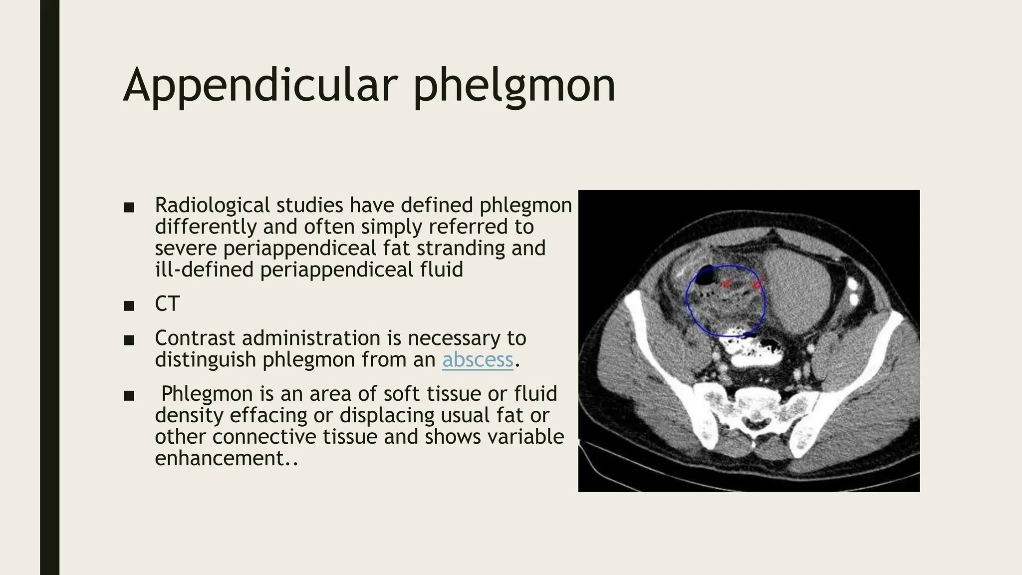 Acute Abdomen Imaging 2 Pptxacute Abdomen Imaging 2 Pptxacute Abdomen