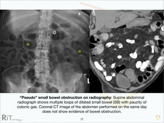 Imaging Acute Abdomen (Part 1)